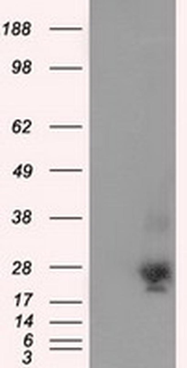 NME4 Antibody in Western Blot (WB)