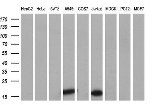 NME4 Antibody in Western Blot (WB)