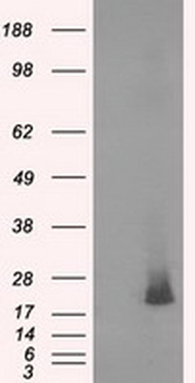 NME4 Antibody in Western Blot (WB)