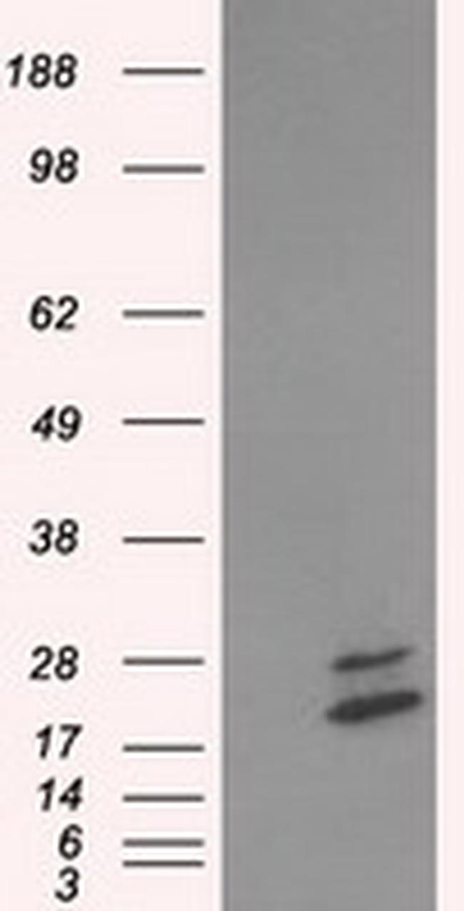 NME4 Antibody in Western Blot (WB)