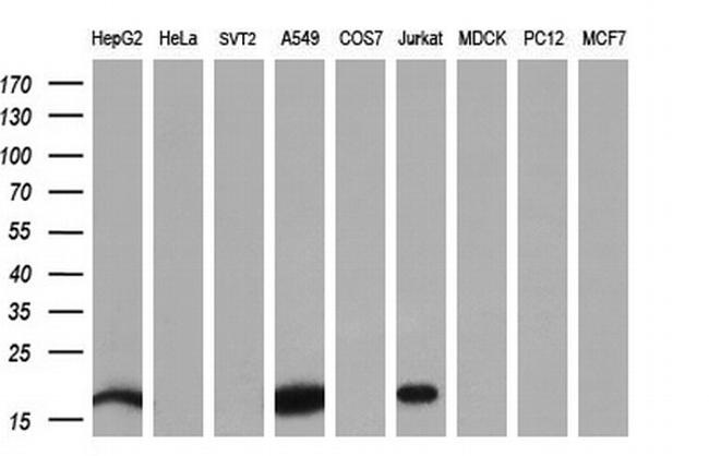 NME4 Antibody in Western Blot (WB)