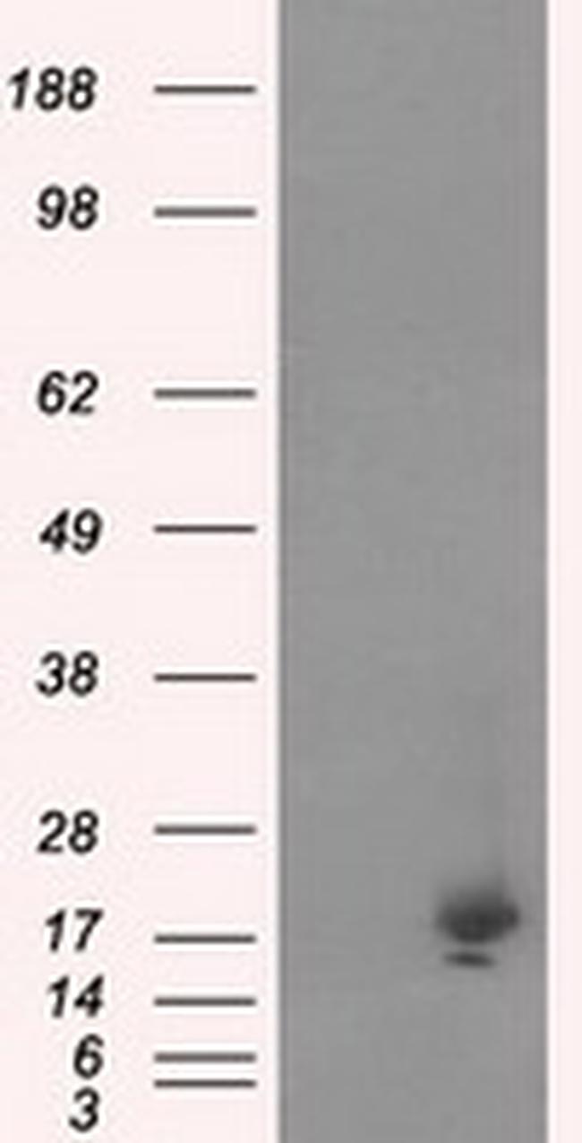 NME4 Antibody in Western Blot (WB)