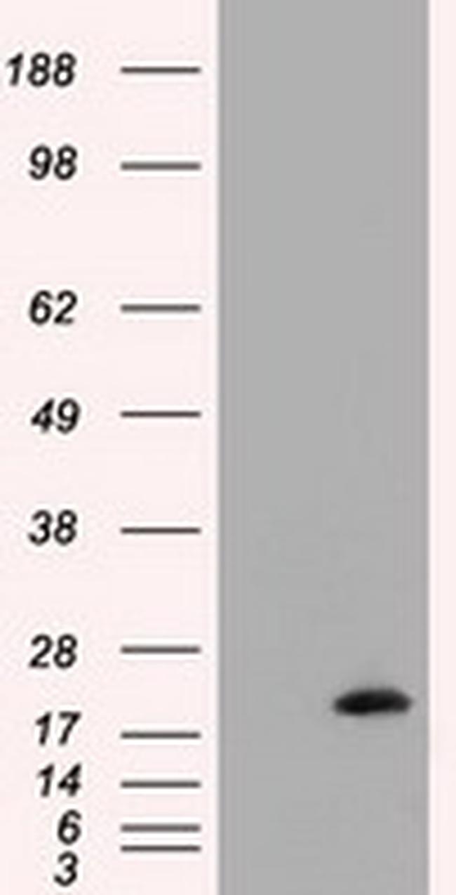 NME4 Antibody in Western Blot (WB)