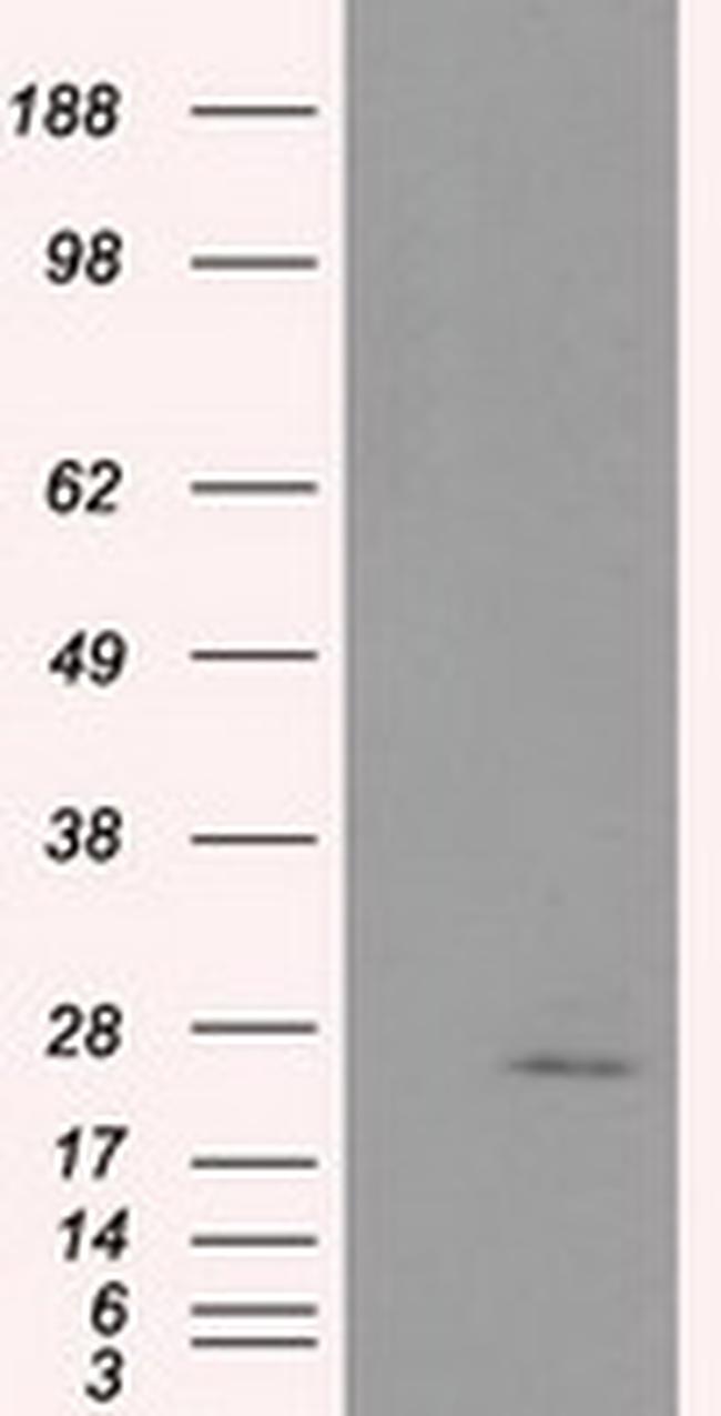 NME4 Antibody in Western Blot (WB)