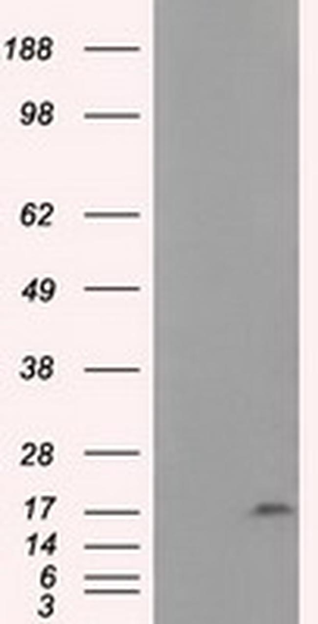 NME4 Antibody in Western Blot (WB)