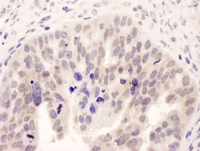 NMI Antibody in Immunohistochemistry (IHC)