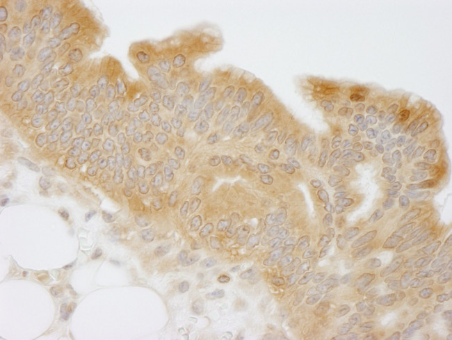 NMI Antibody in Immunohistochemistry (IHC)