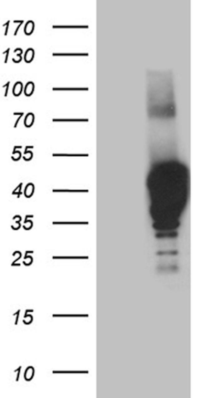 NMI Antibody in Western Blot (WB)