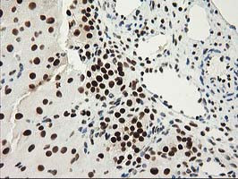 NMNAT1 Antibody in Immunohistochemistry (Paraffin) (IHC (P))