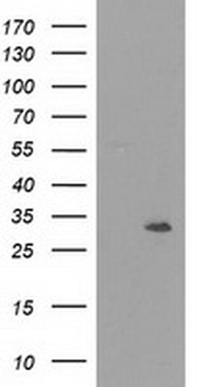 NMNAT1 Antibody in Western Blot (WB)