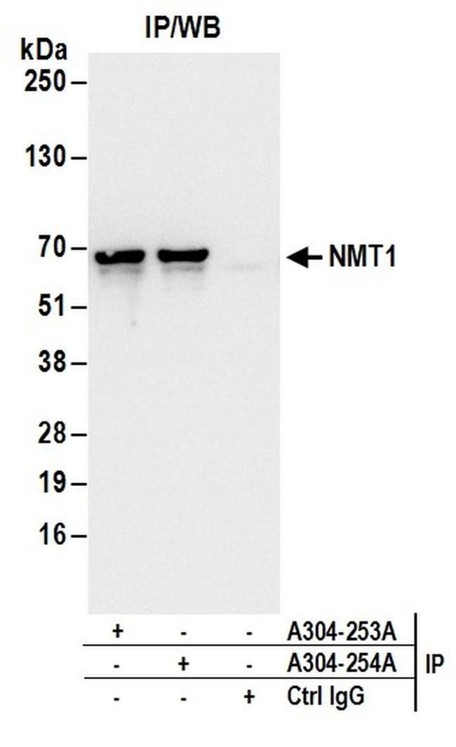 NMT1 Antibody in Western Blot (WB)