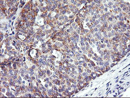 NMT2 Antibody in Immunohistochemistry (Paraffin) (IHC (P))