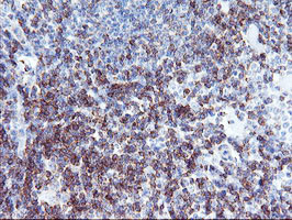 NMT2 Antibody in Immunohistochemistry (Paraffin) (IHC (P))