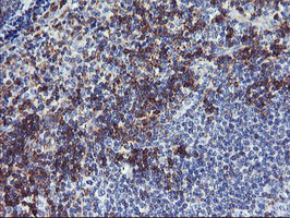 NMT2 Antibody in Immunohistochemistry (Paraffin) (IHC (P))