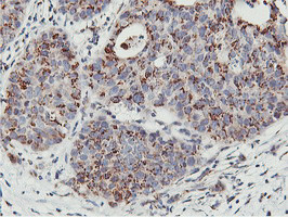 NMT2 Antibody in Immunohistochemistry (Paraffin) (IHC (P))