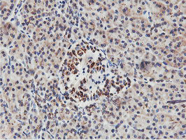 NMT2 Antibody in Immunohistochemistry (Paraffin) (IHC (P))