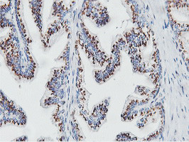 NMT2 Antibody in Immunohistochemistry (Paraffin) (IHC (P))