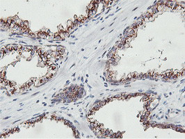 NMT2 Antibody in Immunohistochemistry (Paraffin) (IHC (P))