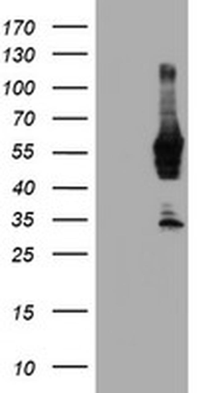 NMT2 Antibody in Western Blot (WB)