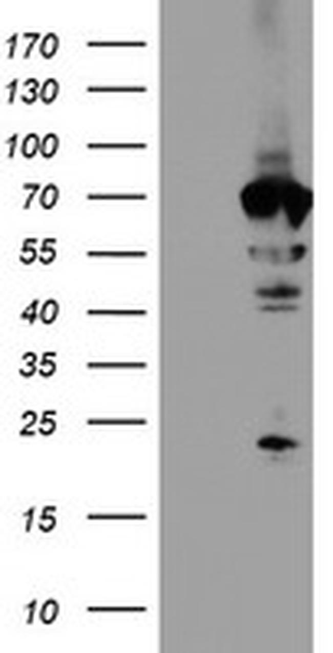 NMT2 Antibody in Western Blot (WB)