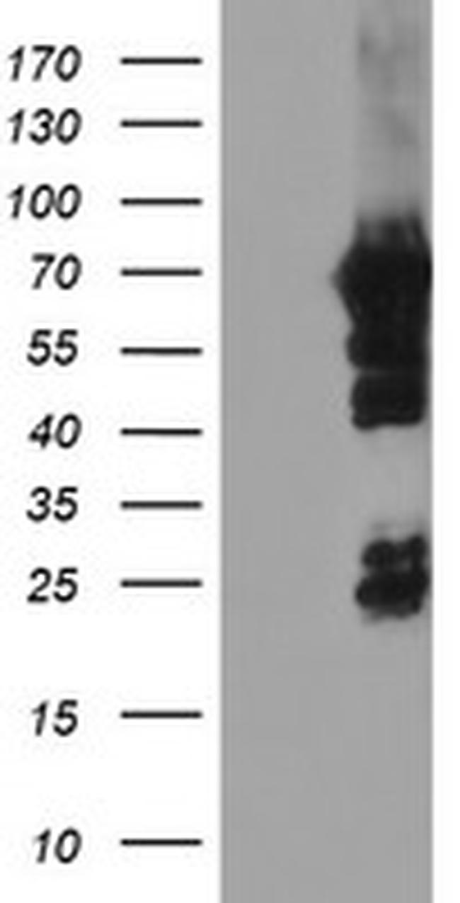 NMT2 Antibody in Western Blot (WB)