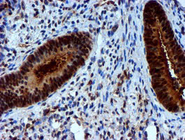 NNMT Antibody in Immunohistochemistry (Paraffin) (IHC (P))