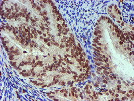 NNMT Antibody in Immunohistochemistry (Paraffin) (IHC (P))