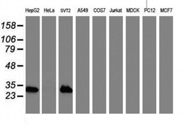 NNMT Antibody in Western Blot (WB)