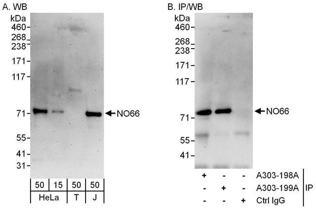 NO66 Antibody in Western Blot (WB)