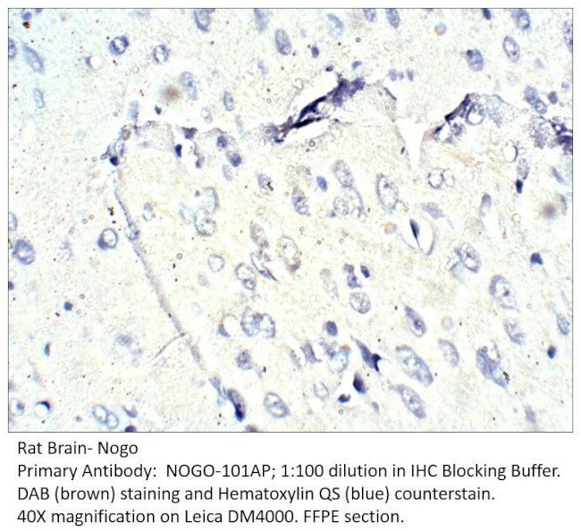 Nogo Antibody in Immunohistochemistry (IHC)
