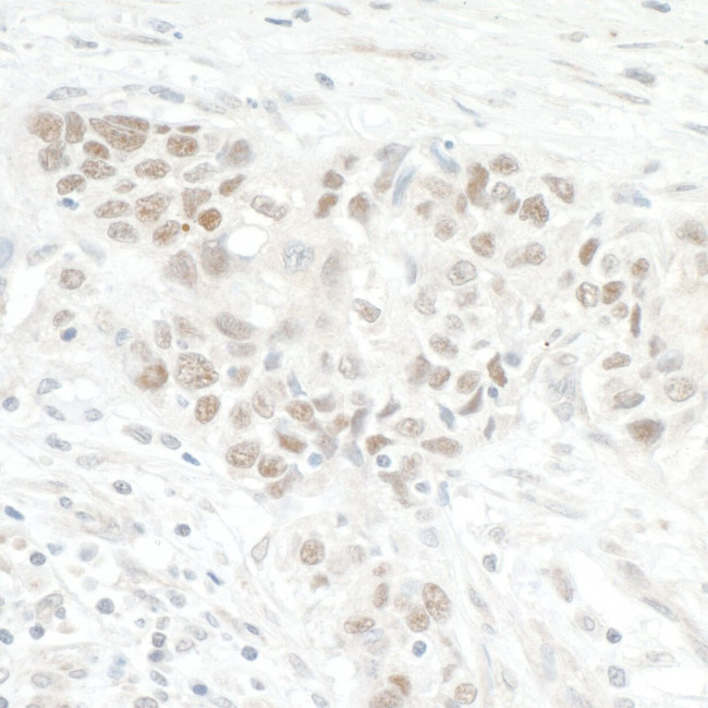 NOL12 Antibody in Immunohistochemistry (IHC)