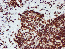 NONO Antibody in Immunohistochemistry (Paraffin) (IHC (P))