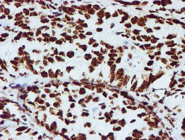 NONO Antibody in Immunohistochemistry (Paraffin) (IHC (P))