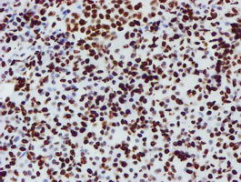 NONO Antibody in Immunohistochemistry (Paraffin) (IHC (P))