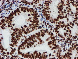 NONO Antibody in Immunohistochemistry (Paraffin) (IHC (P))