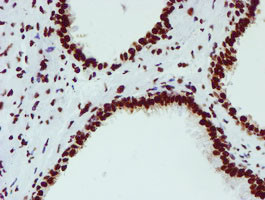 NONO Antibody in Immunohistochemistry (Paraffin) (IHC (P))