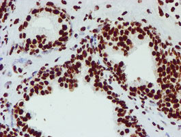 NONO Antibody in Immunohistochemistry (Paraffin) (IHC (P))