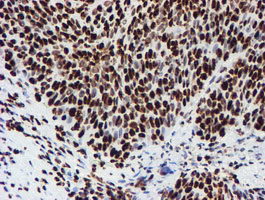 NONO Antibody in Immunohistochemistry (Paraffin) (IHC (P))