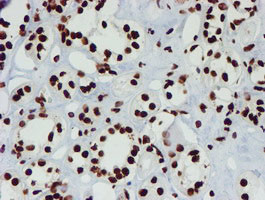 NONO Antibody in Immunohistochemistry (Paraffin) (IHC (P))