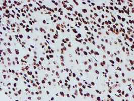 NONO Antibody in Immunohistochemistry (Paraffin) (IHC (P))