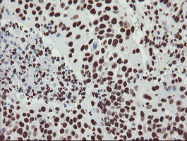 NONO Antibody in Immunohistochemistry (Paraffin) (IHC (P))