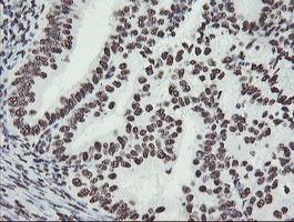 NONO Antibody in Immunohistochemistry (Paraffin) (IHC (P))