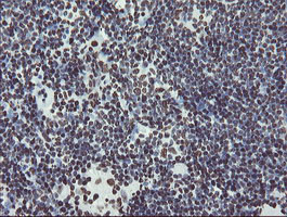 NONO Antibody in Immunohistochemistry (Paraffin) (IHC (P))