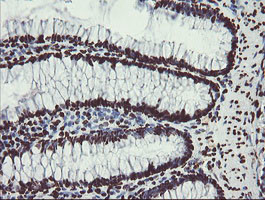 NONO Antibody in Immunohistochemistry (Paraffin) (IHC (P))