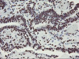 NONO Antibody in Immunohistochemistry (Paraffin) (IHC (P))