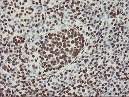 NONO Antibody in Immunohistochemistry (Paraffin) (IHC (P))