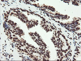 NONO Antibody in Immunohistochemistry (Paraffin) (IHC (P))