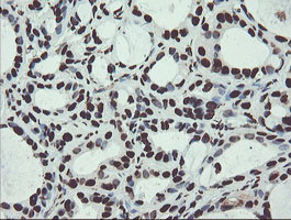 NONO Antibody in Immunohistochemistry (Paraffin) (IHC (P))