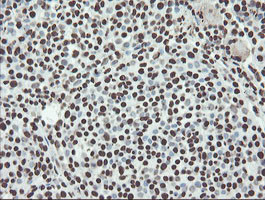 NONO Antibody in Immunohistochemistry (Paraffin) (IHC (P))