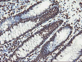 NONO Antibody in Immunohistochemistry (Paraffin) (IHC (P))